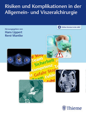 cover image of Risiken und Komplikationen in der Allgemein- und Viszeralchirurgie